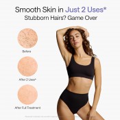 מכשיר להסרת שיער בטכנולוגיית IPL ואפקט קוביית הקרח Ulike Air 10 